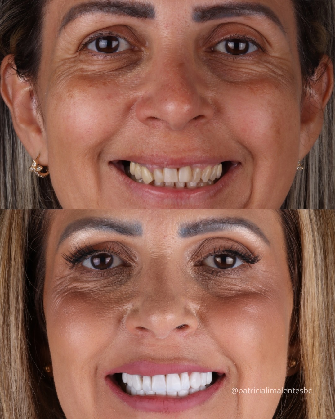 Antes e Depois 7